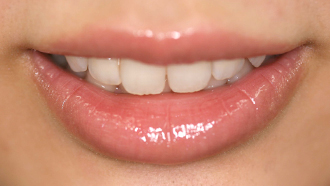 自然歯のようなツヤと色を実現するセラミックスとは